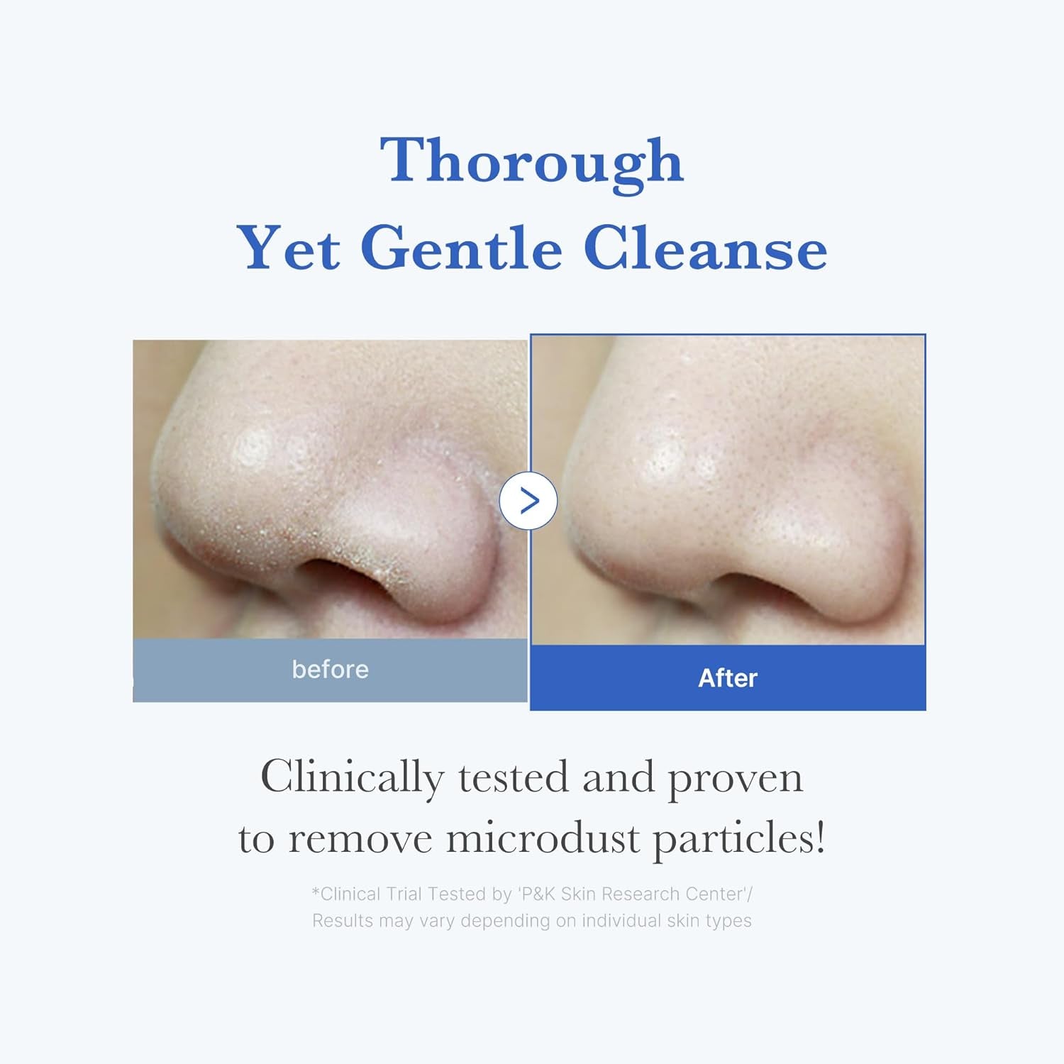 Facial Cleanser Zero Foam Cleanser for Pore & Excess Oil Care
